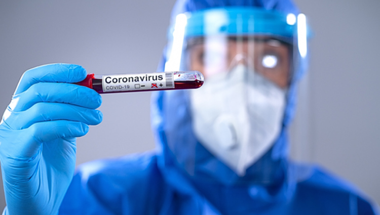 Egressos de Biomedicina da Escola de Saúde atuam no processamento dos testes Covid-19 na Unisinos