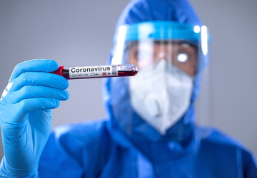Egressos de Biomedicina da Escola de Saúde atuam no processamento dos testes Covid-19 na Unisinos